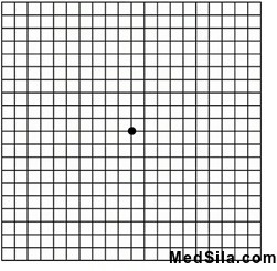 Сетка Амслера